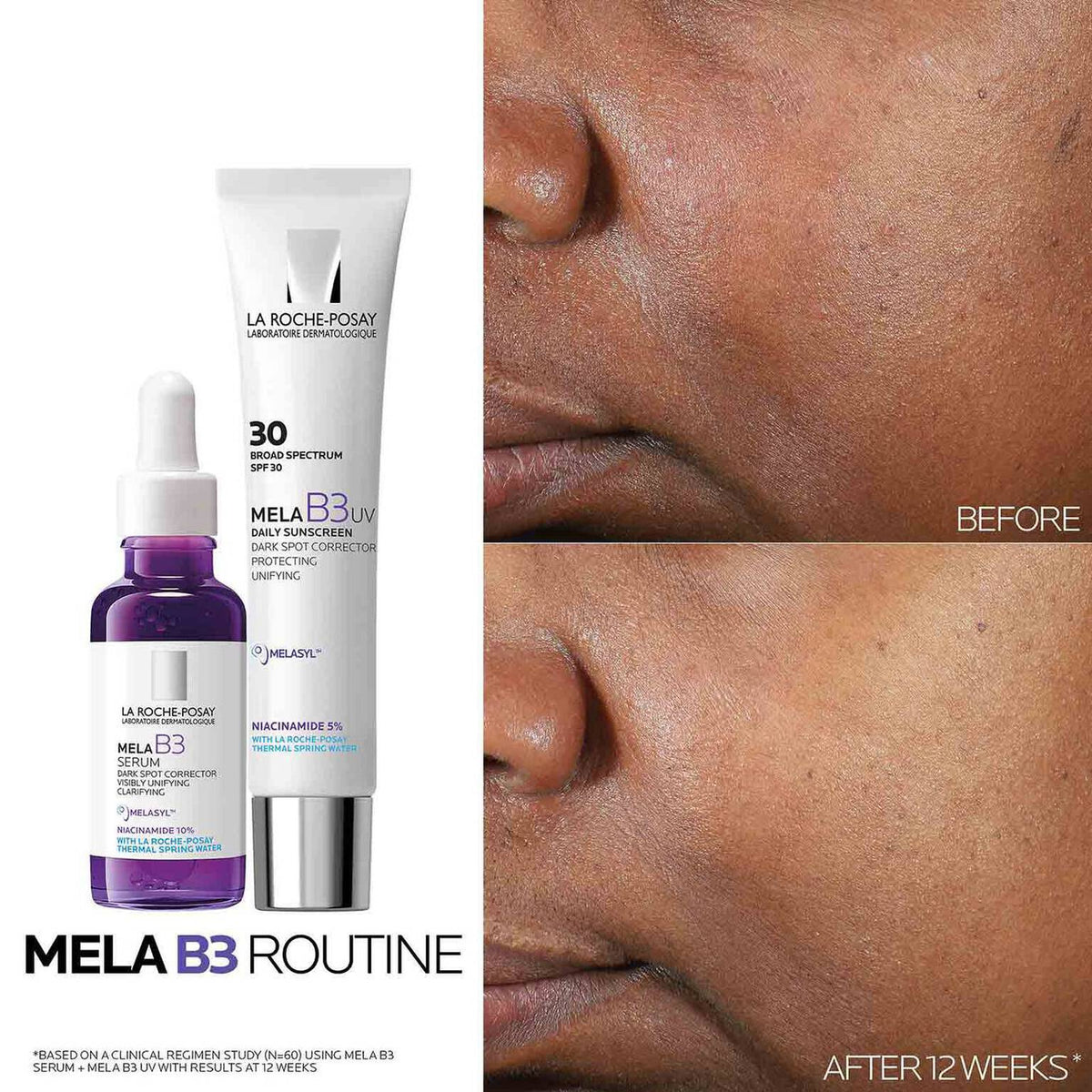 mela-b3-dark-spot-serum-and-mela-b3-uv-daily-moisturizer-with-spf-30-i0 3-Mela-B3-routine_1500X1500.jpg 3-Mela-B3-routine_1500X1500_699afb5eaaaf.jpg