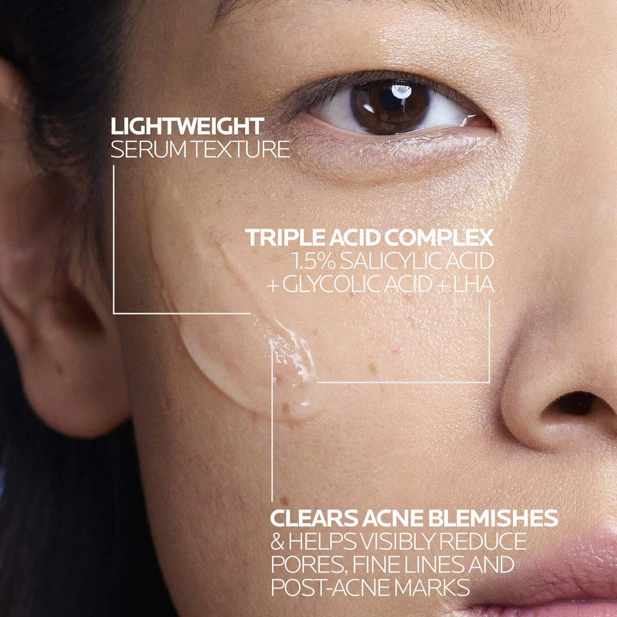 effaclar-salicylic-acid-acne-treatment-serum-q3 LaRochePosay-Product-Effaclar-Effaclar-Serum-30ml-3337875722827-Texture-REV.jpg LaRochePosay-Product-Effaclar-Effaclar-Serum-30ml-3337875722827-Texture-REV_243050550f1c.jpg
