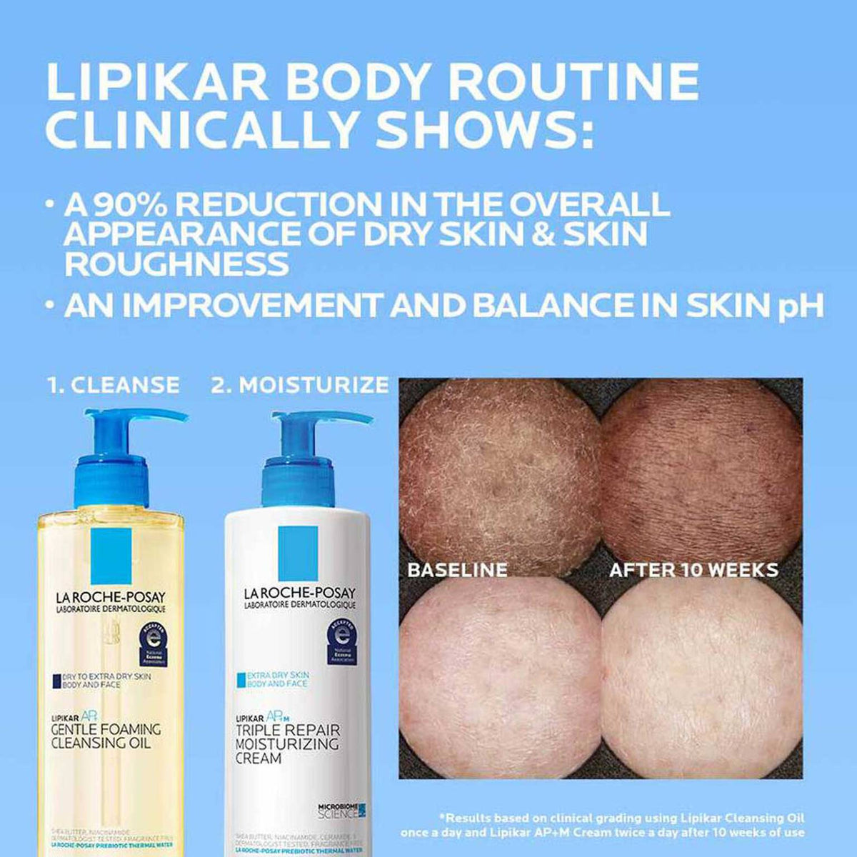 lipikar-ap-gentle-foaming-cleansing-oil-q5 Lipikar-clinical-study-banner_1500x1500.jpg Lipikar-clinical-study-banner_1500x1500_aca631b528b1.jpg