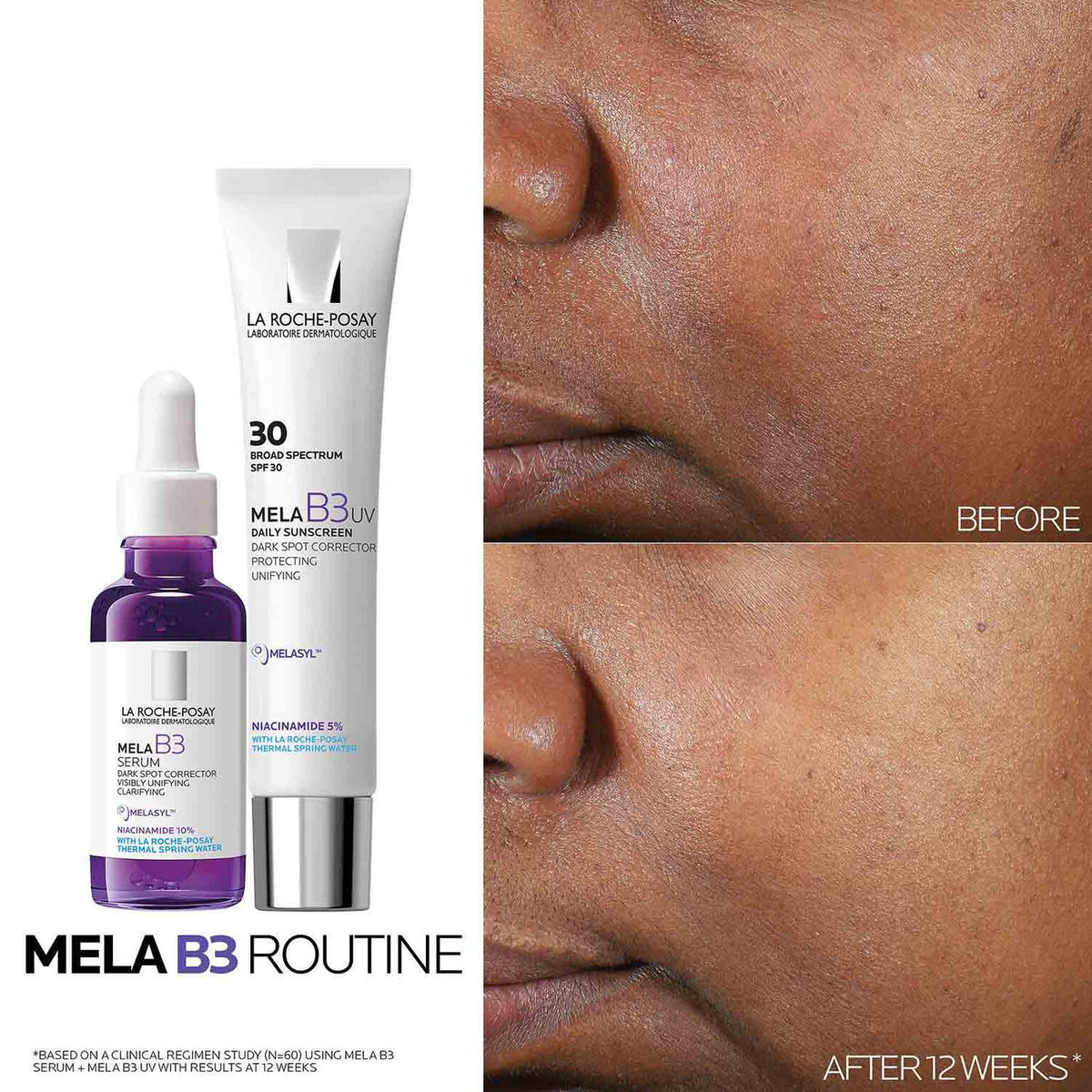 mela-b3-uv-daily-moisturizer-spf-30-with-melasyltm-niacinamide-k6 Mela-B3-routine_1500X1500.jpg Mela-B3-routine_1500X1500_4218e8d2a51a.jpg