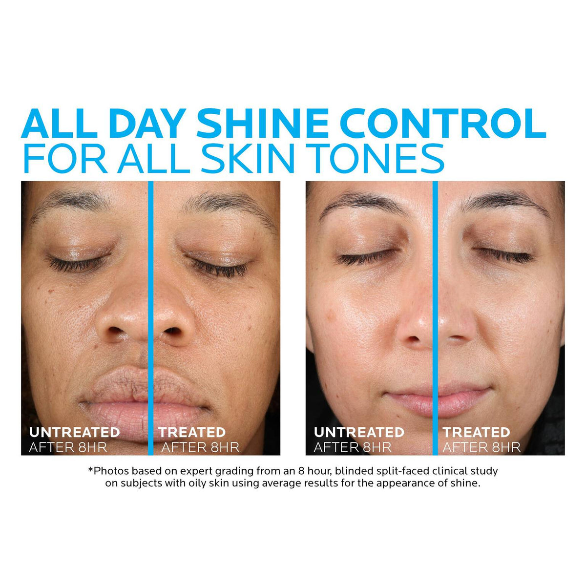 toleriane-double-repair-matte-face-moisturizer-for-oily-skin-l5 la-roche-posay-toleriane-matte-moisturizer-before-and-after-pdp-alt.jpg la-roche-posay-toleriane-matte-moisturizer-before-and-after-pdp-alt_29894fb3234d.jpg
